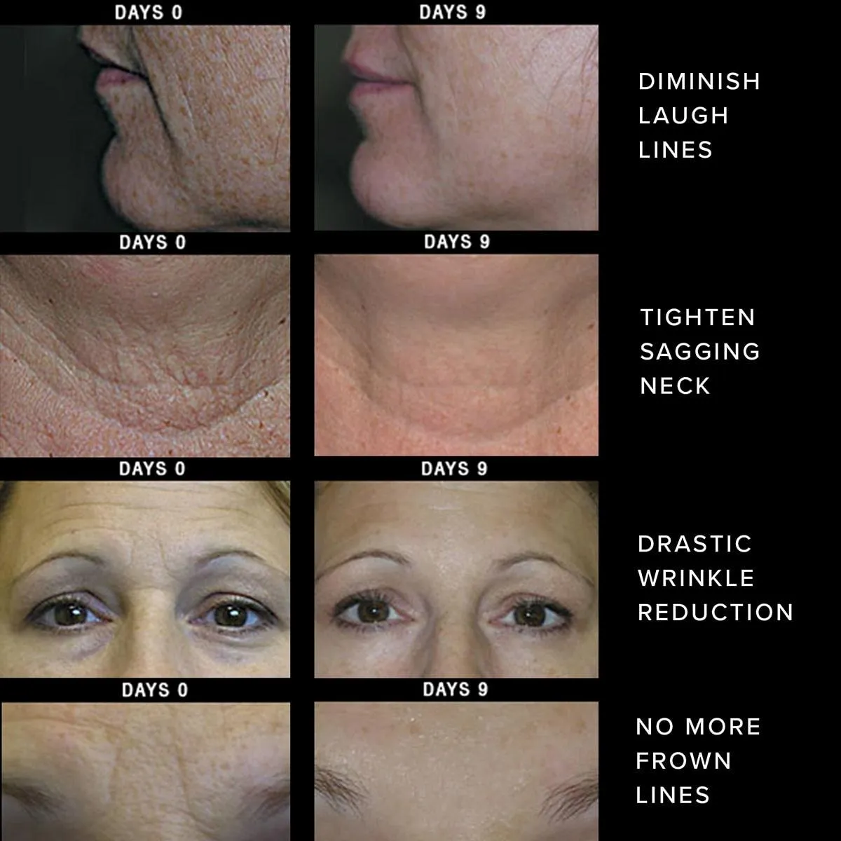 Stemulift Moisturizer - Image 3